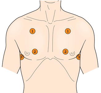 Locations for feeling fremitus: front.