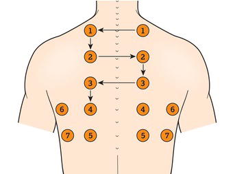 Ladder pattern for percussion and auscultation of the chest.