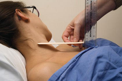 Measuring a jugular venous pressure.