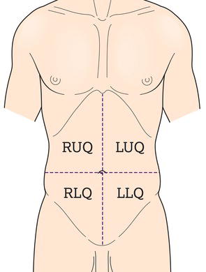 The four quadrants of the abdomen. LLQ, left lower quadrant; LUQ, left upper quadrant; RLQ, right lower quadrant; RUQ, right upper quadrant.