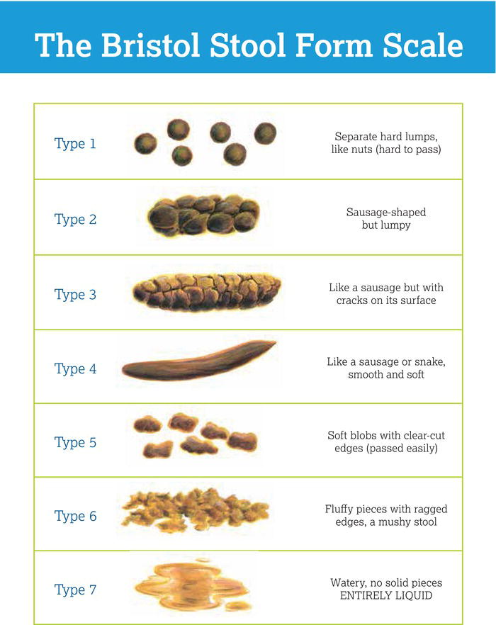 Bristol Stool Chart. Source: Courtesy of Dr. K.W. Heaton, Reader in Medicine at the University of Bristol. Reproduced with permission of Norgine Pharm