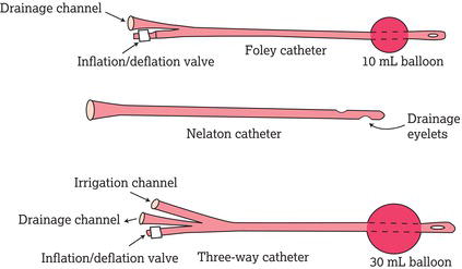 Types of catheter.