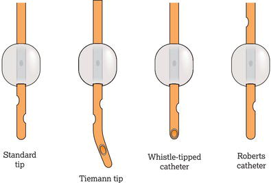 Catheter tips.