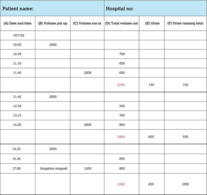 Example bladder irrigation chart.