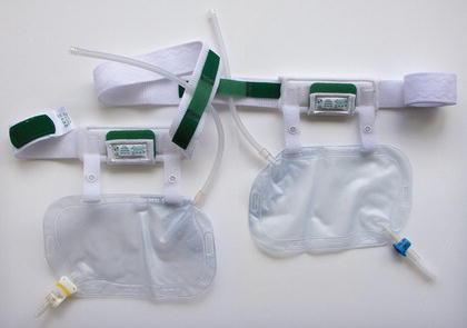 Body‐worn nephrostomy drainage bag and belt system. Source: Reproduced with permission of ManFred Sauer.