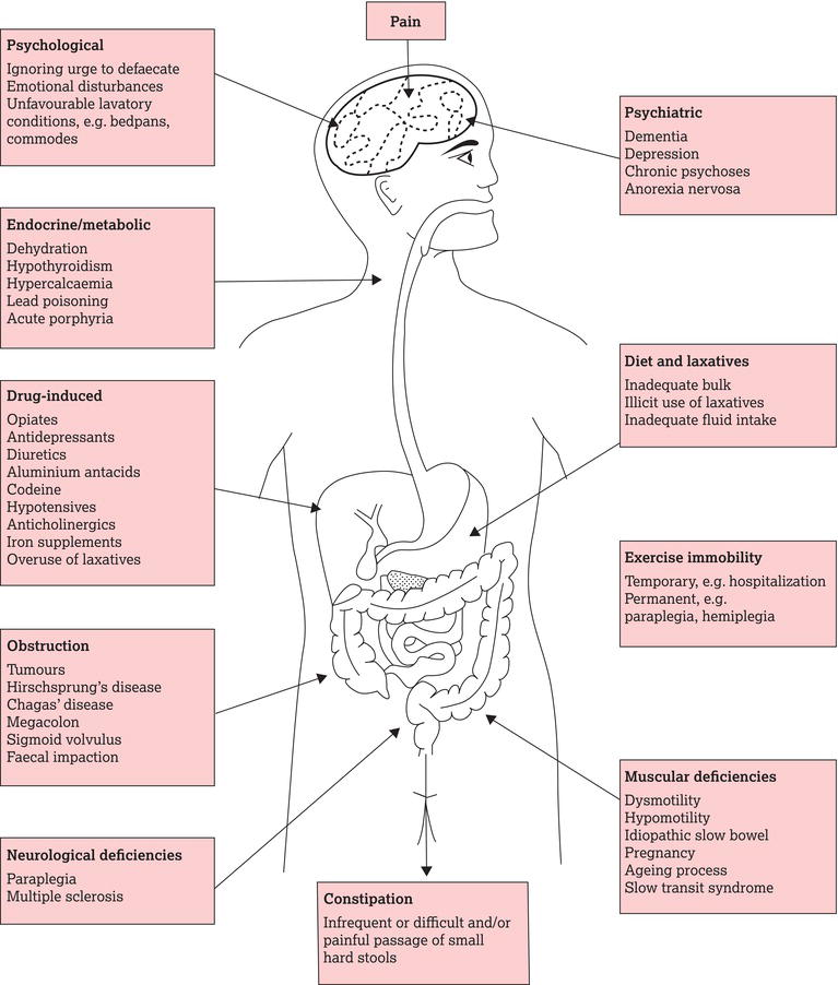 Classification of constipation. Source: Reproduced with permission of The Royal Marsden.