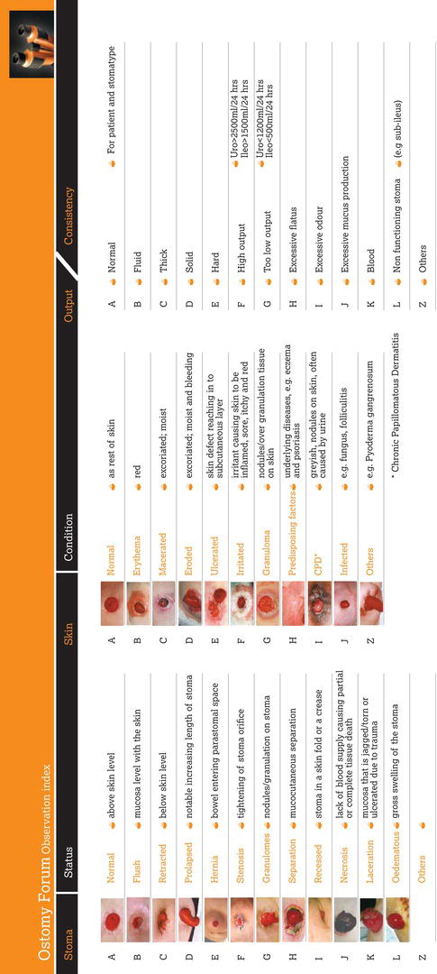 Ostomy observational index. Source: Reproduced with permission of Dansac Ltd.