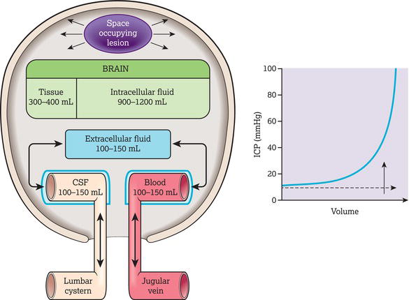 Causes of raised intracranial pressures. CSF, cerebrospinal fluid; ICP, intracranial pressure.