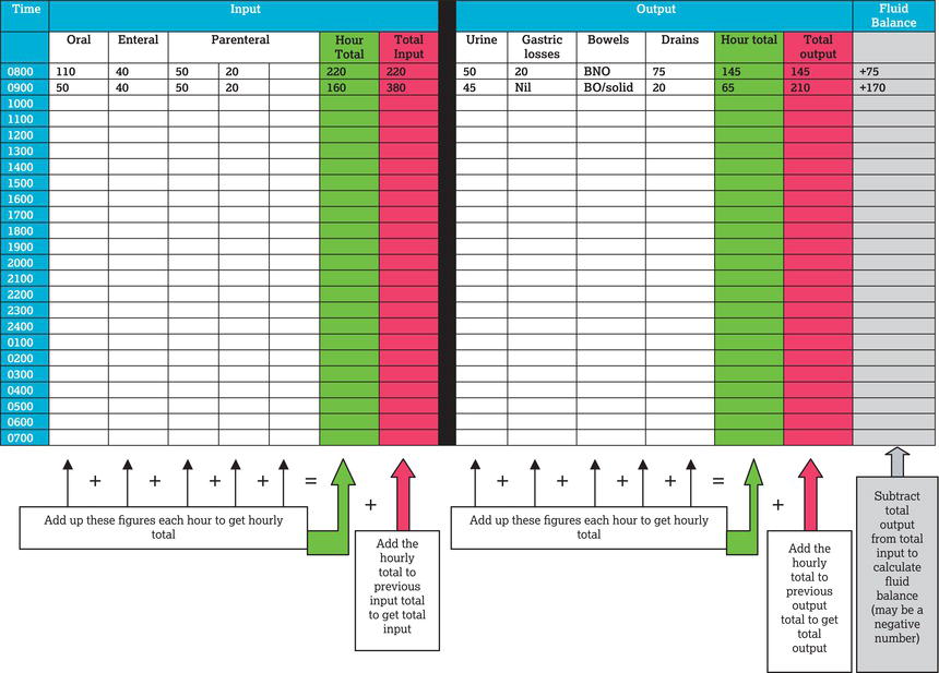 Example of a fluid balance chart.