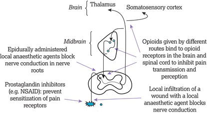 The pain pathway, showing key sites for particular analgesic interventions.