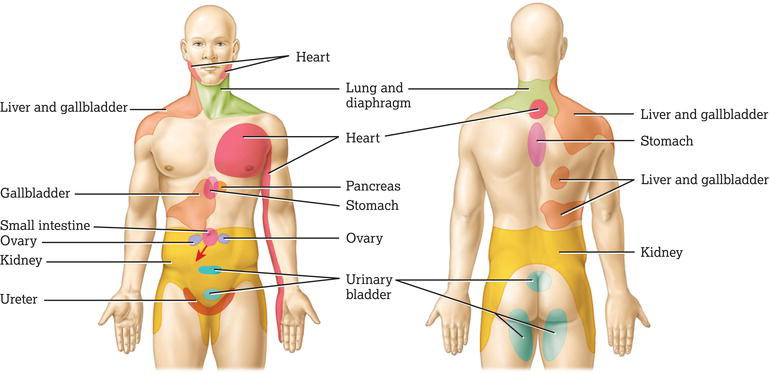 Distribution of referred pain. Source: Reproduced from Tortora and Derrickson () with permission of John Wiley & Sons.