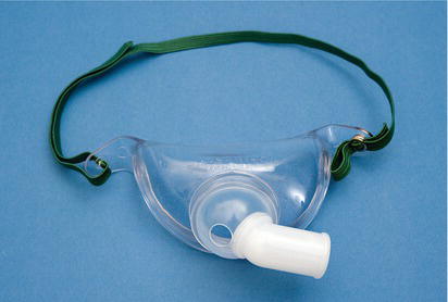 Tracheostomy mask.