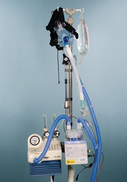 Continuous positive airway pressure (CPAP) bellows.