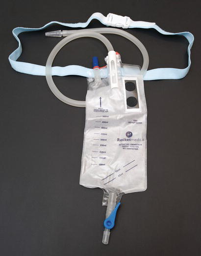 Ambulatory chest drain bag with Heimlich valve.