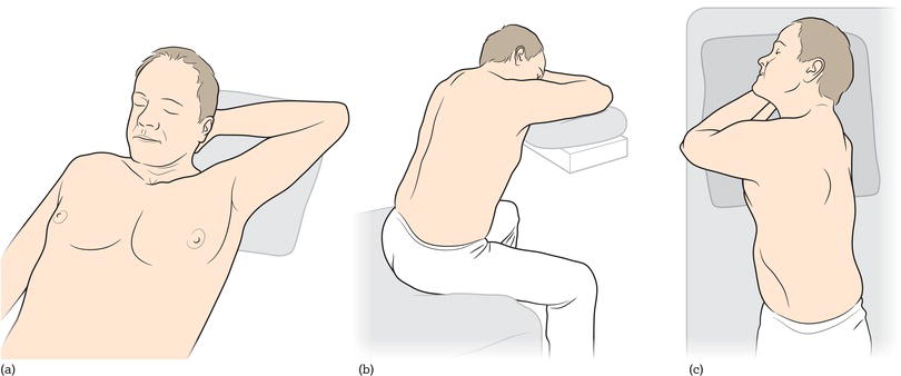 Alternative positions for chest drain insertion. (a) Supine on the bed with the arm on the affected side placed behind the head away from the chest wa