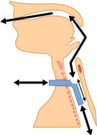 Uncuffed tracheostomy tube in situ. 
Source: Reproduced with permission from the National Tracheostomy Safety Project (www.tracheostomy.org.uk).