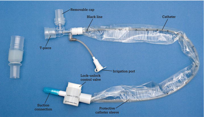 Components of a closed‐circuit catheter. The control valve locks the vacuum on or off. The catheter is protected inside an airtight sleeve. A T‐piece 