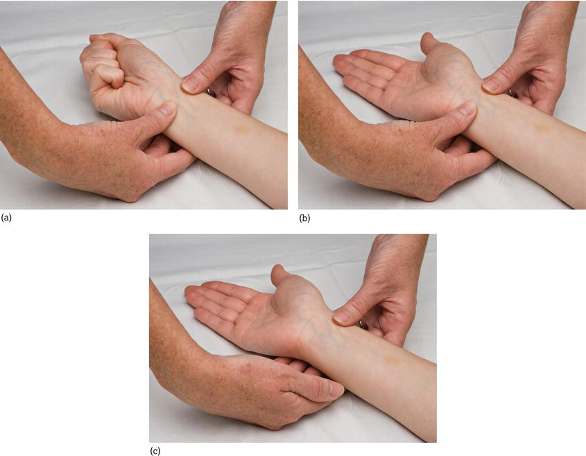 Modified Allen test. (a) Step 1: firmly compress the radial and ulnar arteries while the patient clenches their fist. (b) Step 2: ask the patient to o