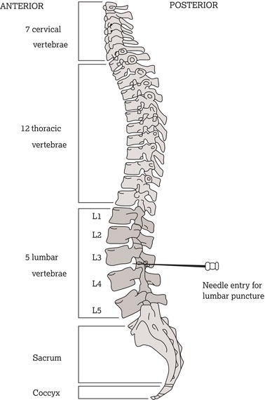 Lateral view of the spinal column and vertebrae, showing the needle entry site for a lumbar puncture.