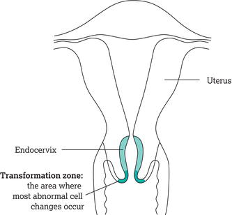 The cervix.