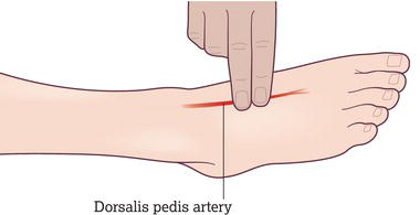 Dorsalis pedis pulse. Source: Reproduced from Peate and Wild () with permission of John Wiley & Sons.