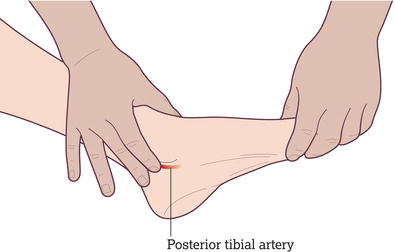 Posterior tibial pulse. Source: Reproduced from Peate and Wild () with permission of John Wiley & Sons.