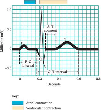 A normal electrocardiogram (ECG) (lead II). P wave, arterial depolarization; QRS complex, onset of ventricular depolarization; T wave, ventricular rep