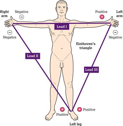 Einthoven triangle.