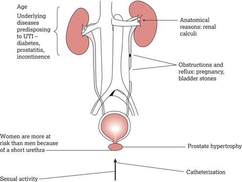 Reasons for predisposition to urinary tract infections (UTIs).