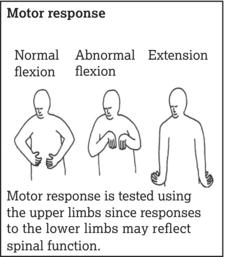 Normal and abnormal flexion and extension.