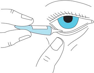 How to instil eye ointment.