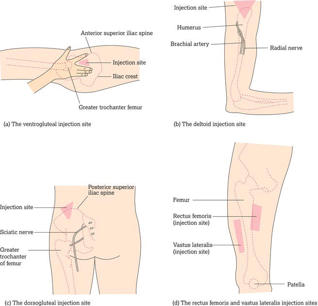 Intramuscular injection sites. Source: Adapted from Rodger and King () with permission of John Wiley & Sons.