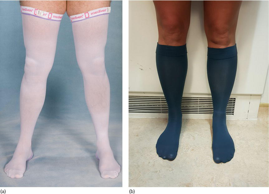 Antiembolic stockings. (a) Thigh length. (b) Knee length.