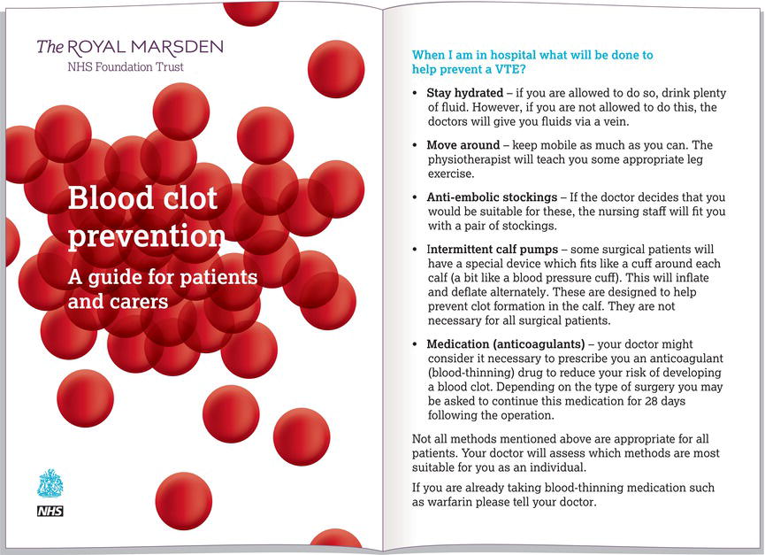 Example of a patient information sheet for deep vein thrombosis (DVT). Source: Adapted from Royal Marsden NHS Foundation Trust () with permission of T