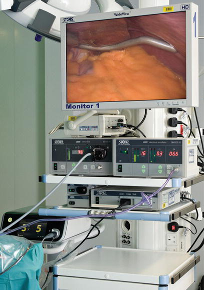 Laparoscopic stack system.