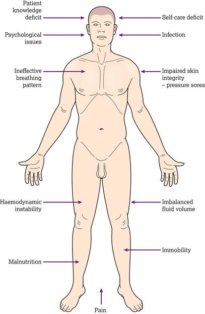 Potential post‐operative complications.