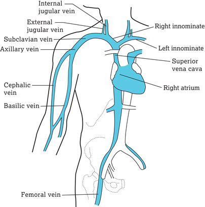 The main veins used for central venous access device placement. Source: Reproduced from Dougherty () with permission of John Wiley & Sons.