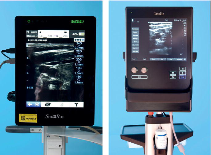 Ultrasound images of veins on screen.