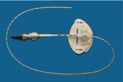 Peripherally inserted central catheter (PICC) with adhesive securing device.