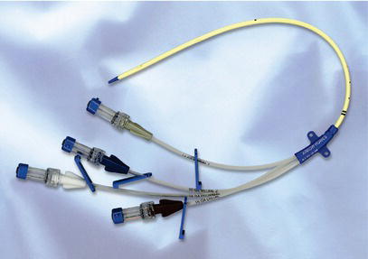 Non‐tunnelled multilumen central venous catheter.