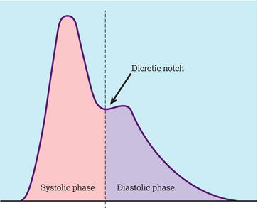 Normal arterial trace.