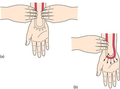 The Allen test.