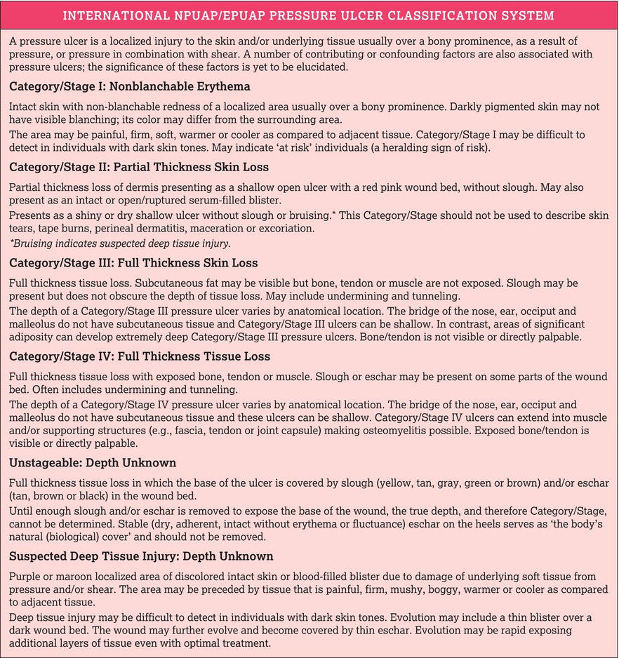 The International National Pressure Ulcer Advisory Panel/European Pressure Ulcer Advisory Panel Pressure Ulcer Classification System. 
Source: Reprodu