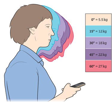 Illustration of weight burden on the spine as the head tips forward.