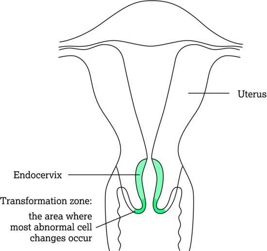 The cervix. Source: Dougherty and Lister ().