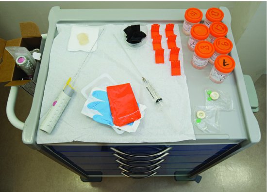 Example of TRUS biopsy equipment.