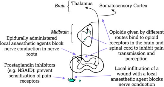 The pain pathway showing key sites for particular analgesic interventions. NSAID, non‐steroidal anti‐inflammatory drug. Source: Dougherty and Lister (