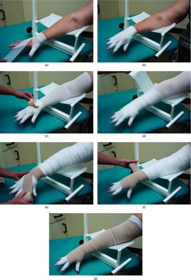 Bandaging an arm and the fingers.