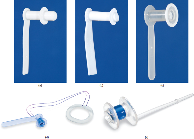 (a) Duckbill Blom‐Singer voice prosthesis. (b) Low‐pressure ex dwelling Blom‐Singer voice prosthesis. (c) Indwelling Blom‐Singer voice prosthesis. (d)